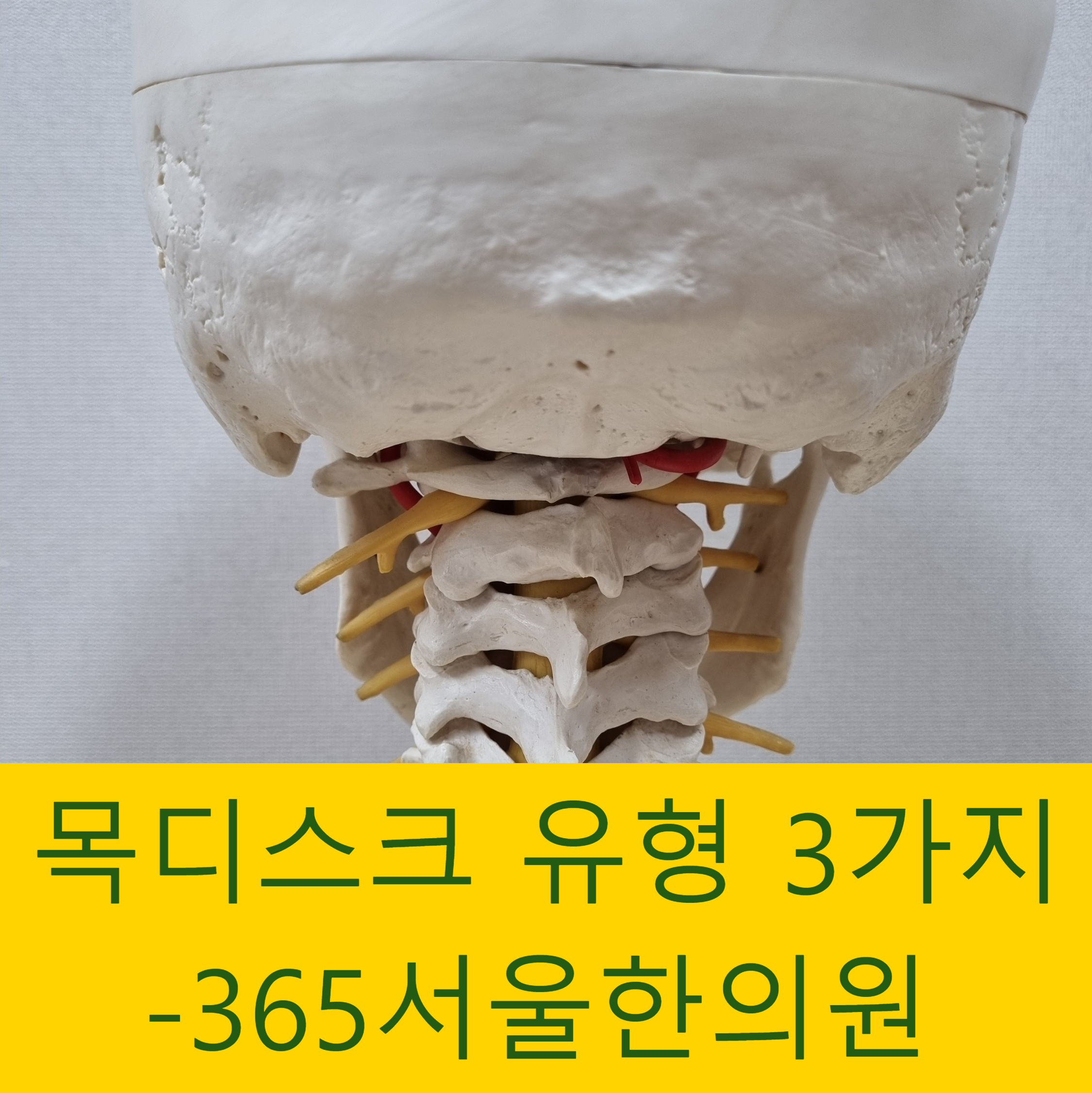 구로 대림역 목디스크 한의원